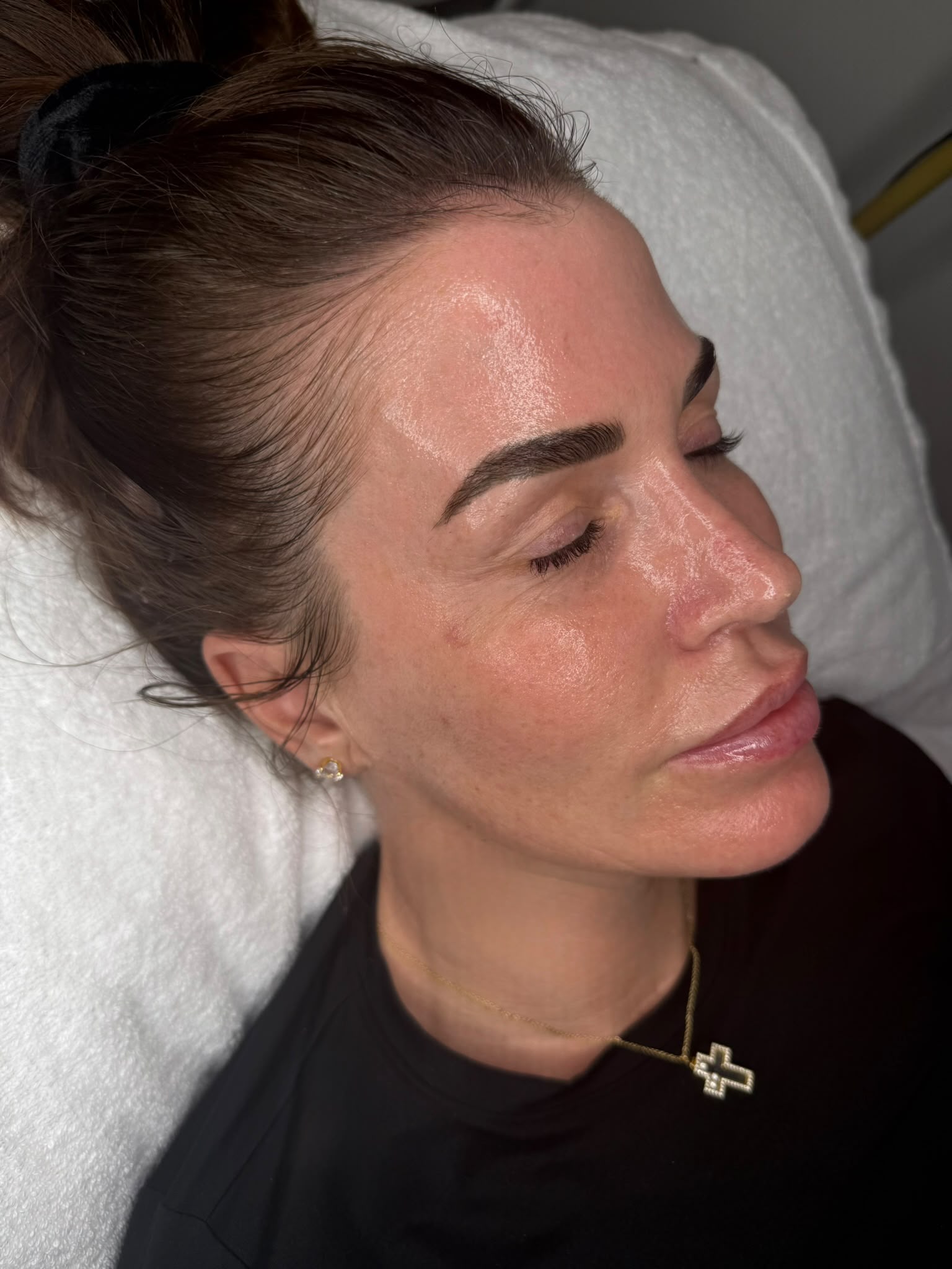 A client resting on the couch after treatment, eyes closed, skin fresh and glowing