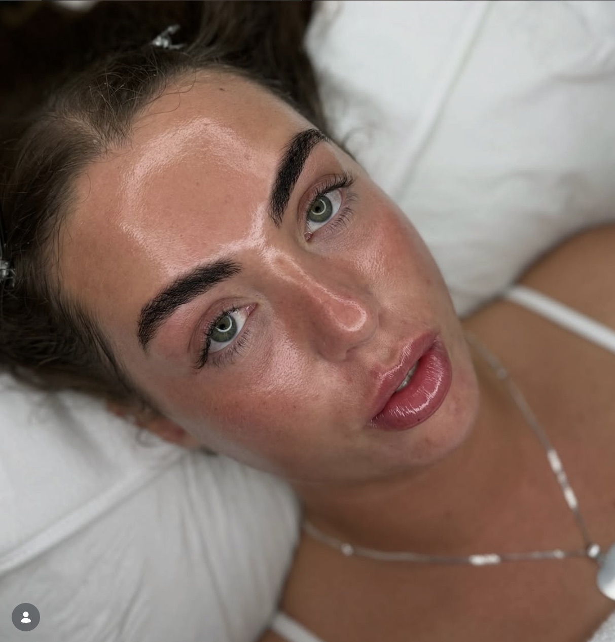 Close up of a client's glowing skin after treatment at Aesthetify