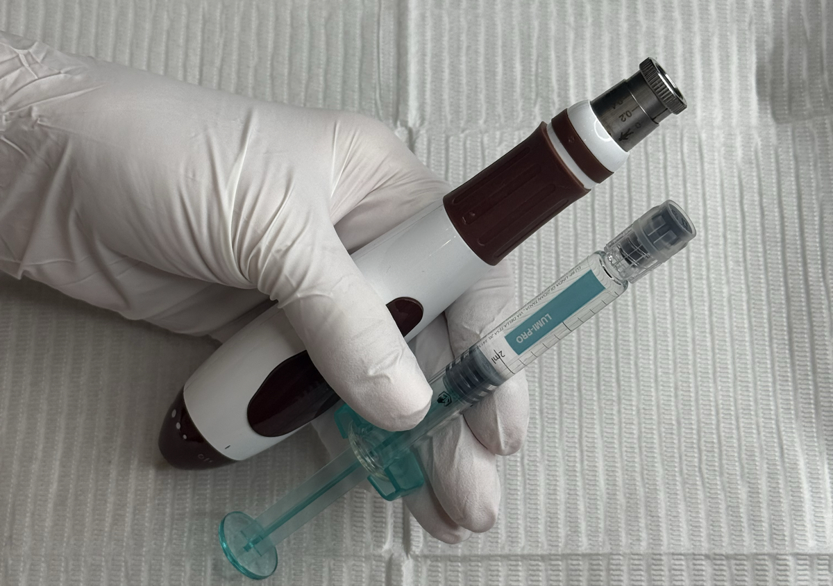 A gloved hand holding the microneedling pen and a syringe of serum over a fresh couch roll