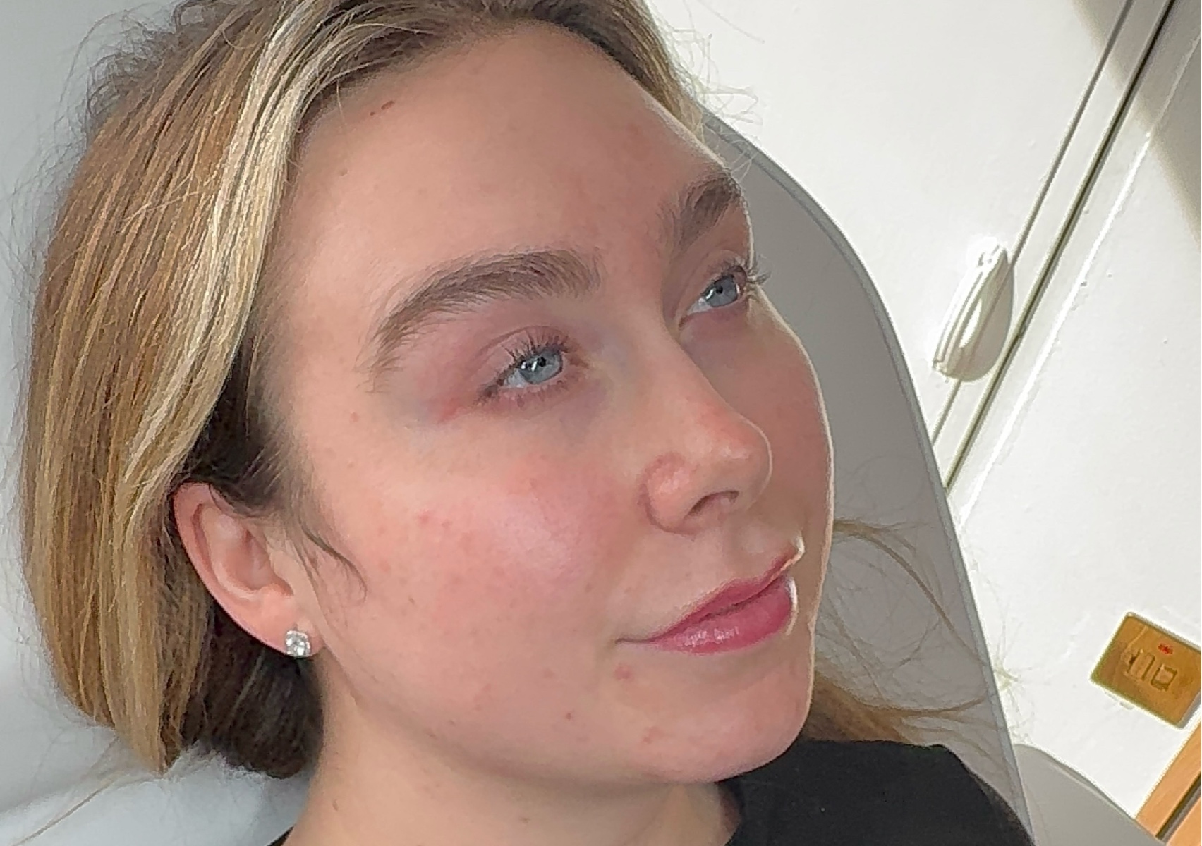 A client's face in soft daylight at the clinic